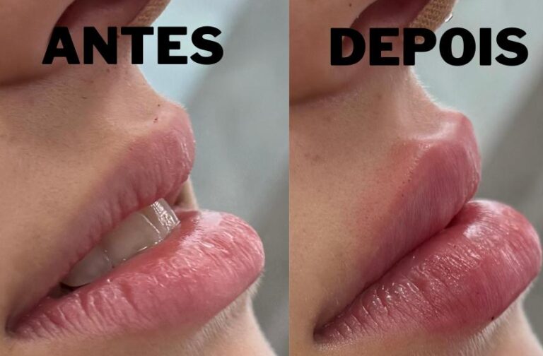 Harmonização Facial: O Que É, Como Funciona, Benefícios, Riscos e Tendências em 2026